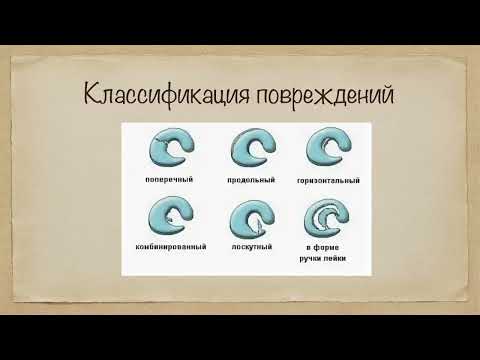 Видео: 2.2. Повреждение менисков коленного сустава: клинические признаки, лечебная тактика.