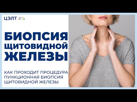 Видео: 🔬 Как проходит процедура пункционная биопсия щитовидной железы. Биопсия щитовидной железы. 12+