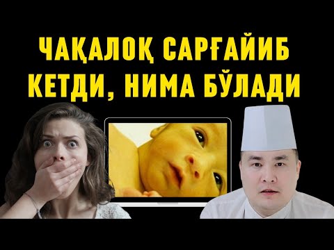 Видео: Чақалоқлар САРҒАЙСА, бу хавфлими? ҲАМА ОТА-ОНАЛАР БИЛИШИ КЕРАК!