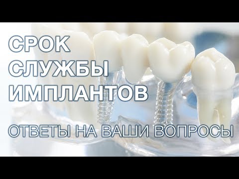 Видео: Какой срок службы зубных имплантов?