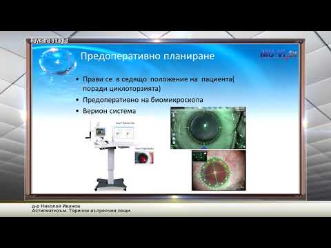 Видео: Aстигматизъм. Торични вътреочни лещи