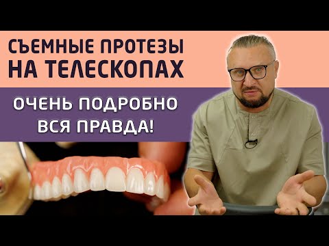 Видео: Показываем съемные зубные протезы Кандулор на телескопах, а так же процесс их установки пациенту.