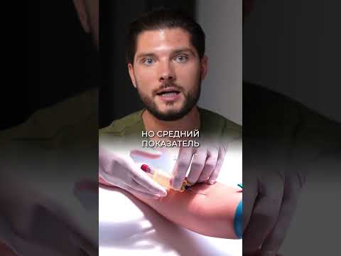 Видео: УЗНАЙ ПРИЧИНУ БЫСТРОГО СТАРЕНИЯ #здоровье #красота #анализкрови