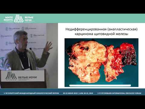 Видео: Гистологическая классификация опухолей щитовидной железы (2017):новое о ранее известном