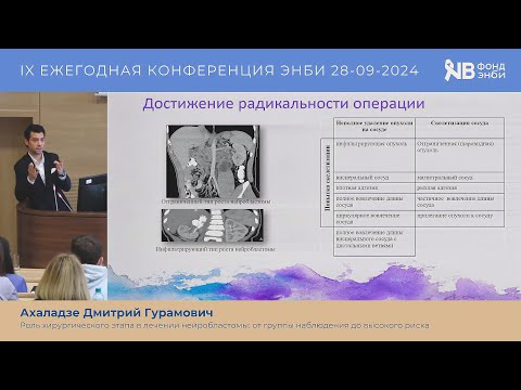 Видео: Ахаладзе Д.Г. Роль хирургического этапа в лечении нейробластомы