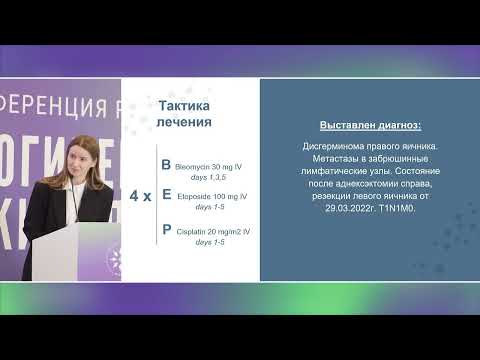 Видео: Разбор клинических случаев: герминогенная опухоль яичника