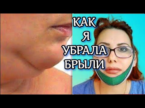 Видео: Как я Убрала Брыли и второй Подбородок. Быстро и Просто.