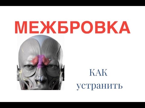 Видео: ✅КАК устранить МЕЖБРОВКУ?