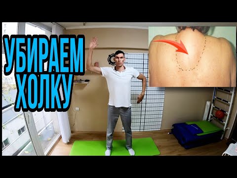 Видео: Как убрать холку на шее Жировик How to Get Rid of a Neck Hump