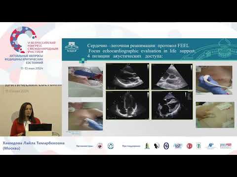 Видео: УЗИ у пациентов в критических состояниях Хамидова Л.Т.