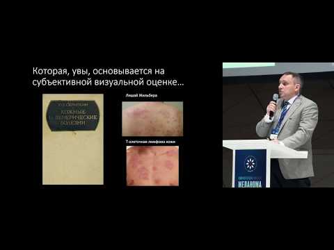 Видео: Неинвазивная диагностика меланомы. Неужели появился свет в конце туннеля?