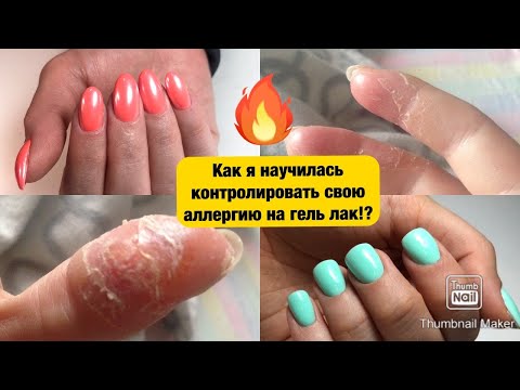 Видео: Аллергия на гель-лак! Научилась жить с аллергией на шеллак. Почему возникает аллергия на гель лак?!