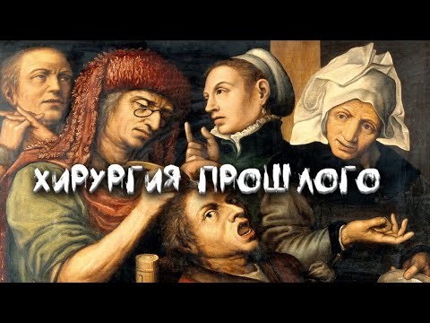 Видео: Ужасы и открытия в истории хирургии