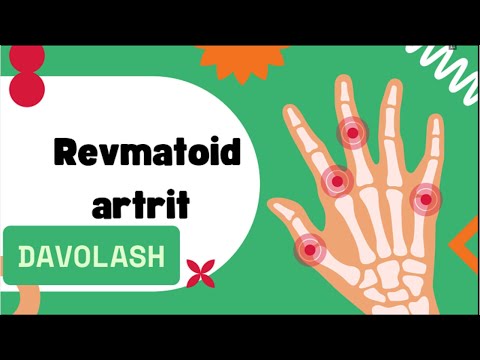 Видео: Ревматоид Артрит: Белгилари, Даволаш Йўллари ва Қандай Яшаш Мумкин