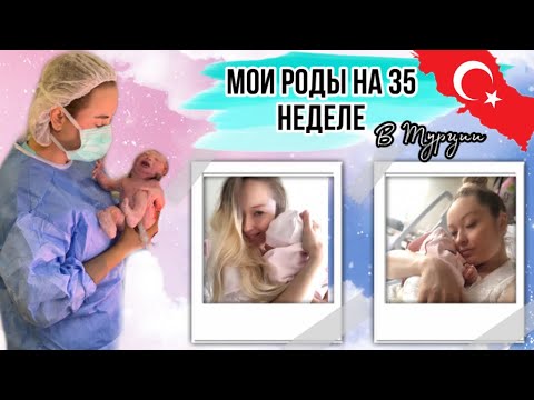 Видео: Роды на 35 неделе / Преждевременные РОДЫ / РОДЫ в Турции