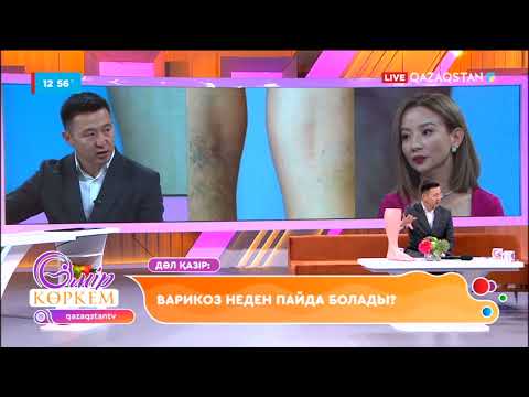 Видео: Варикоз неден пайда болады? І Өмір көркем