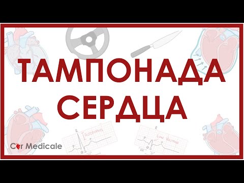 Видео: Тампонада сердца