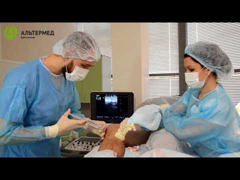 Видео: Эндовенозная лазерная коагуляция