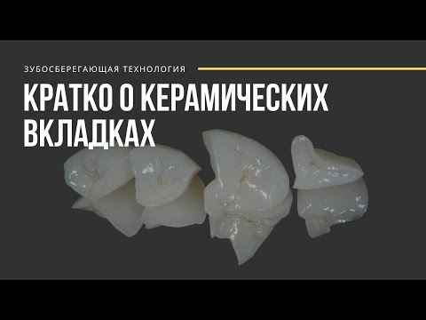Видео: Лечение кариеса (пломбы, вкладки): за и против. Владимир Ордовский-Танаевский