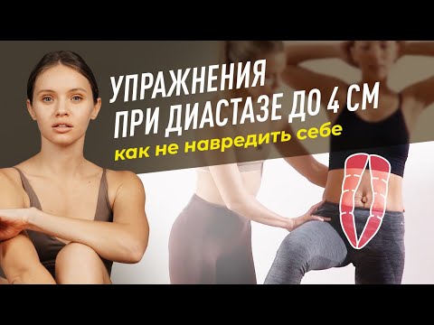 Видео: Тренировки, которые можно выполнять при диастазе до 4 см в ширину