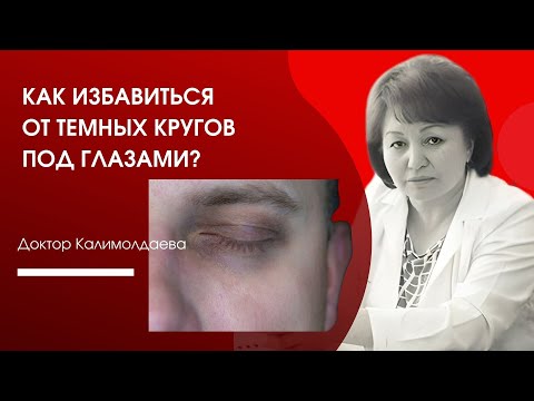 Видео: Как избавиться от темных кругов под глазами?