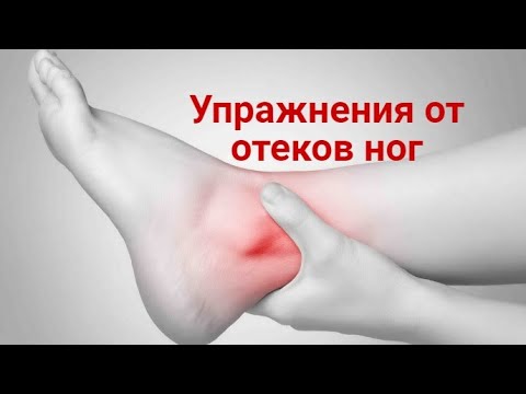 Видео: Отеки и боли ног. Простые упражнения от отеков и боли в ногах.