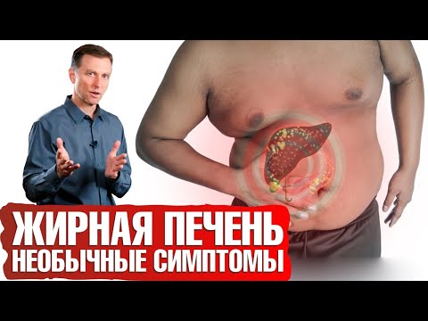 Видео: Симптомы жировой печени (жировой гепатоз): вы бы и не подумали, что дело в печени...😨