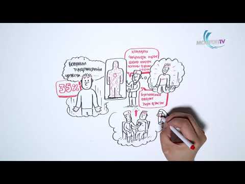 Видео: Нянгийн шалтгаант эндокардит