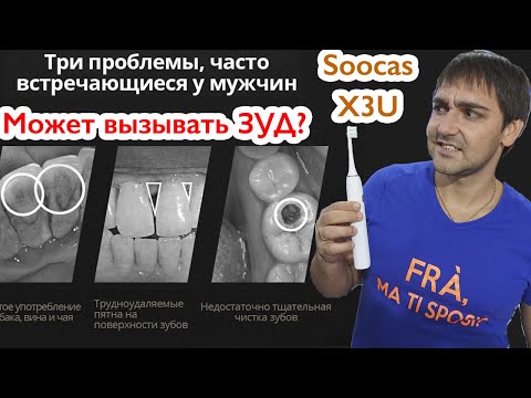 Видео: Soocas X3U - электрическая ультразвуковая щетка может вызывать зуд?!