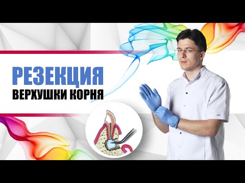 Видео: резекция верхушки корня зуба