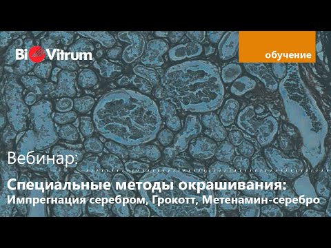 Видео: Специальные методы окрашивания: Импрегнация серебром, Гримелиус, Грокотт, Метенамин-серебро