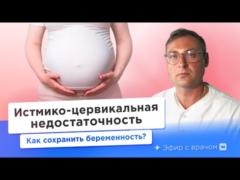 Видео: Истмико-цервикальная недостаточность. Можно ли обойтись без пессария?
