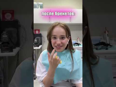 Видео: КАК МОЯ ЖИЗНЬ ИЗМЕНИЛАСЬ С БРЕКЕТАМИ #shorts #tiktok # a4 #брекеты