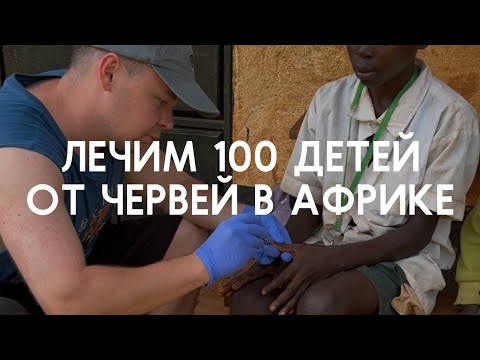 Видео: Лечим 100 детей от червей в ногах в Кении