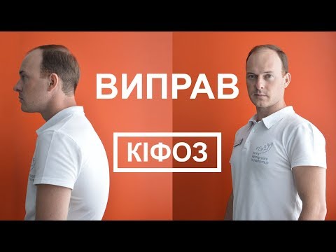 Видео: Як виправити кіфоз