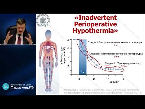Видео: Управление температурой тела пациента Лебединский КМ