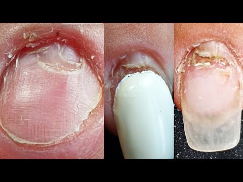 Видео: ТРЕШ НАТВОРИЛА С НОГТЯМИ 😪