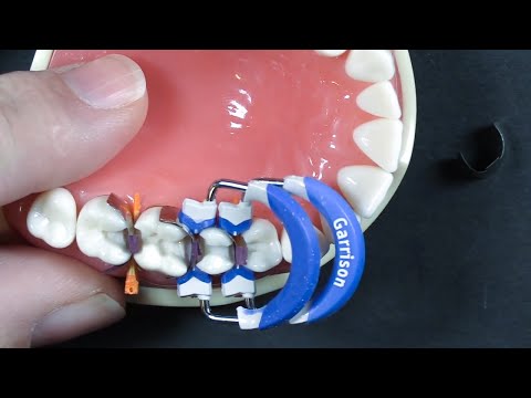 Видео: 5 самых популярных вопросов: № 1 | Второй класс подряд