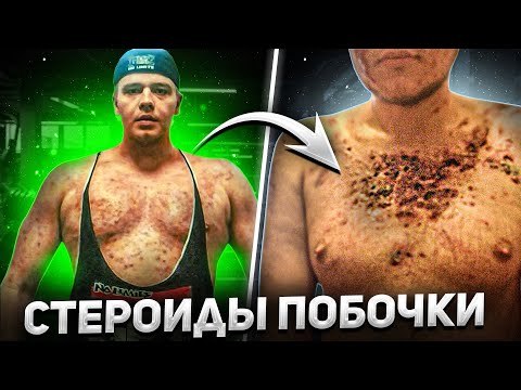 Видео: ВЛАД ХОТЕЛ СТАТЬ КАЧКОМ, НО СГНИЛ ЗАЖИВО