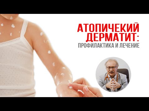 Видео: Атопический дерматит: профилактика и лечение