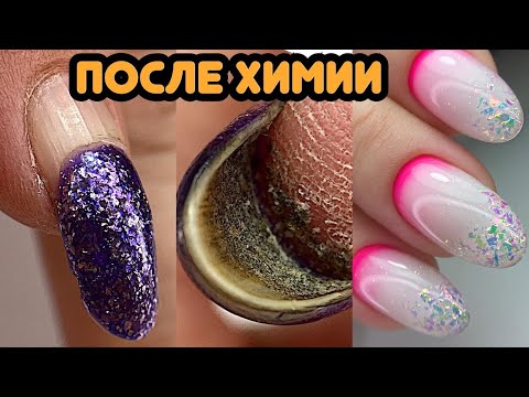 Видео: Ногти после ХИМИИ / 4 месяца ногтям 😱 Необычное наращивание ногтей для новичков