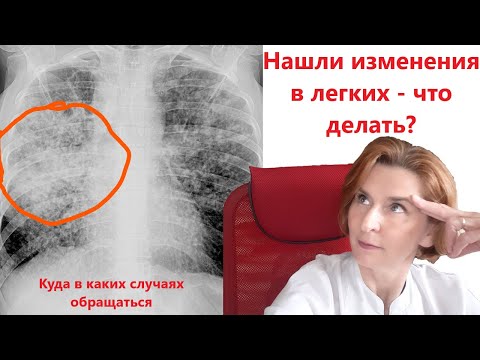 Видео: Изменения в легких на рентгене