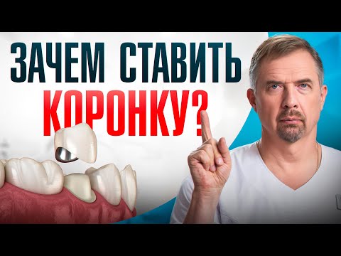 Видео: ПЛОМБА ИЛИ КОРОНКА? Важные нюансы, о которых молчат стоматологи