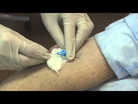 Видео: Пункция и катетеризация периферической вены (локтевой)