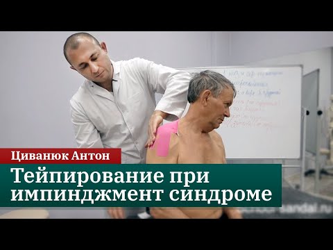 Видео: Тейпирование при боли в суставах. Импинджмент синдром. Прикладная кинезиология. Циванюк Антон