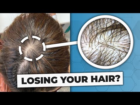 Видео: Объяснение телогеновой алопеции (причины и протоколы восстановления)