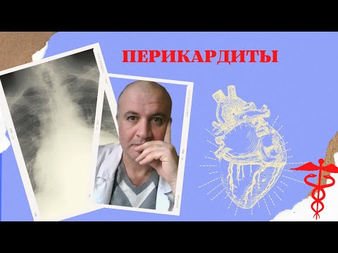 Видео: ПЕРИКАРДИТ: Что вызывает воспаление сердечной сумки?