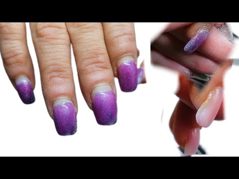 Видео: Сложные ногти клюющий ноготь коррекция ногтей #майстерманікюру#весна