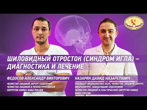 Видео: Шиловидный отросток (Синдром Игла) - диагностика и лечение