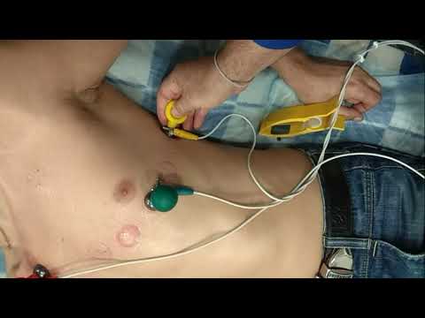 Видео: ЭКГ ПО НЭБУ(Небу)